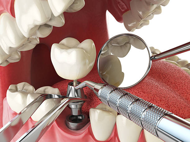 Best Emergency Denture Repair in Vinton, TX