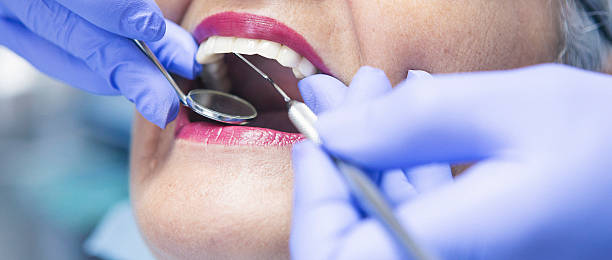 Best Emergency Treatment for Dental Infections or Abscesses in Vinton, TX